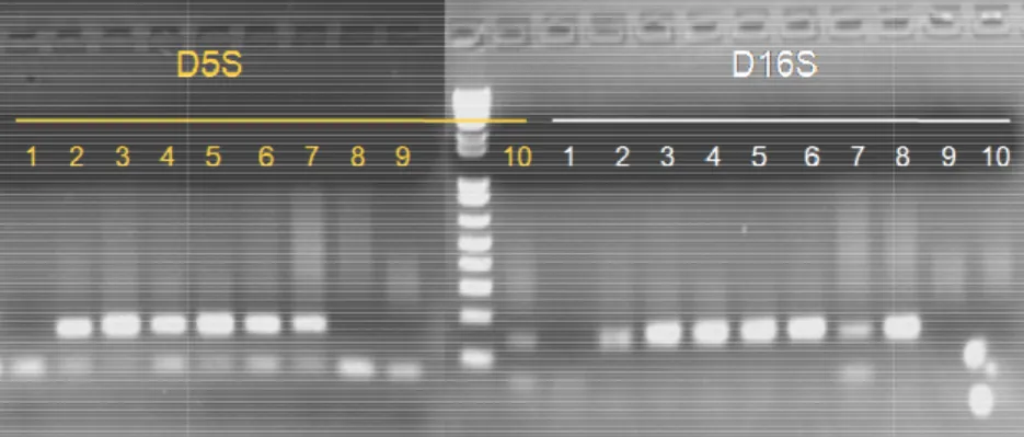 Abbildung 5:  Gelelektrophoresebild einer Kontroll Gelb markiert die Kontroll-PCR mit D