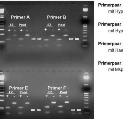 Abbildung 7:  Beispiel eines internen Fragment Alle Primerpaare wurden an Einzelzellen (EZ) und Zell