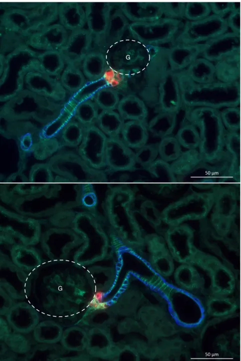 Abbildung 4.1: Oben: Lokalisation von ET A -Rezeptoren in der afferenten Arte- Arte-riole der Niere einer Wildtyp-Maus