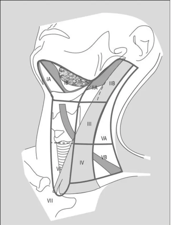 Abb. 2: Anatomische Darstellung des Halses mit den Grenzen der 6 Neck Levels und  der 3 Neck Sublevels, plus Level VII für das  superiore Mediastinum [Robbins et al.,  2008] 