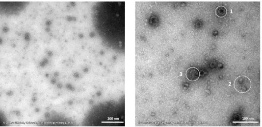 Figure 5.4 TEM images of reassembled BMV capsids with PTA negative staining (left: 40,000x magnification, scale bar: 200  nm; right: 100,000x magnification, scale bar: 100 nm)