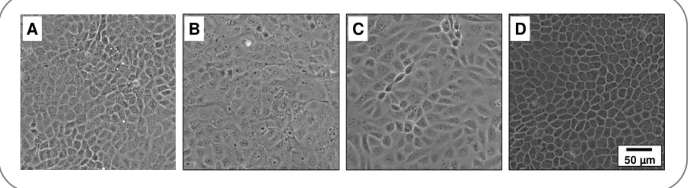 Fig.  3.1:  Phase-contrast  images  of  different  cell  lines  used  in  experiments:  NRK  (A),  MDCK I  (B),  MDCK II  (C),  MDCK II pABCG2 EYFP cells (D)