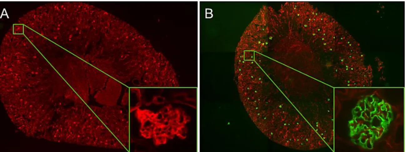 Abb.  5-2:  Fluoreszenz-Aufnahmen  der  Nierenschnitte  von  mTmG  Mäusen.  A.  Nierenquerschnitt  einer  NPHS2-Cre-negativen  Maus