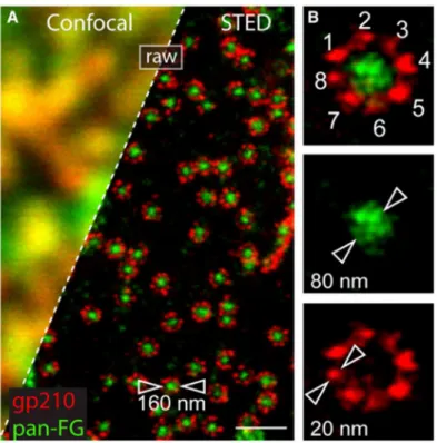 Abb. 6: Fluoreszenznanoskopie von Proteinkomplexen in Kernporen mit dem STED-Mikroskop  A zeigt die immunologisch markierten Untereinheiten eines Kernporenkomplexes (NPC) bei  Am-phibien mit STED im Vergleich zur konfokalen Mikroskopie