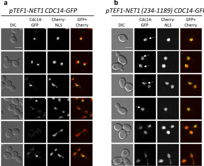 Abb.  10: Die Lokalisation von Cdc14 ist abhängig von Net1. Mittels live-cell imaging wurde der Einfluss eines  N-terminal  verkürzten  Net1-Fragmentes  in  haploiden  Zellen  auf  die  Lokalisation  von  Cdc14  untersucht