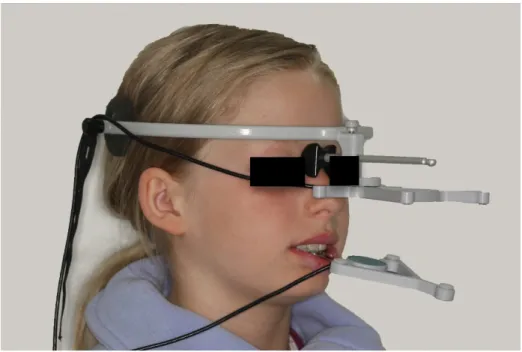 Abb. 5. Patientin im 45°-Winkel von rechts mit angelegtem Gesichtsbogen und Sensoren. 