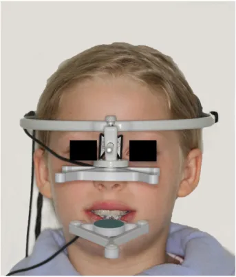 Abb. 6. En Face-Photo der Patientin mit angelegtem Gesichtsbogen und Sensoren. 