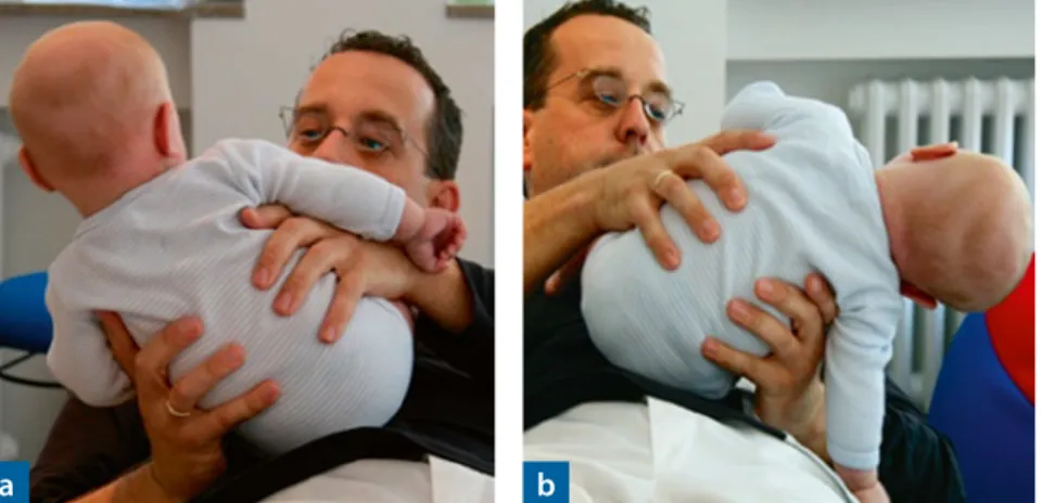 Abb. 1: Gute Seitneigefähigkeit auf der rechten Seite bei einem 3,5 Monate alten Säugling  (a), fehlende Seitneigefähigkeit auf der linken Seite beim gleichen Säugling (b)