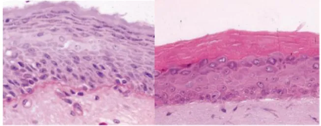 Abbildung 1: Histologischer Schnitt einer humanen  Haut (links) und eines dreidimensionalen  Hautäqui-valents mit Stratum corneum (rechts)