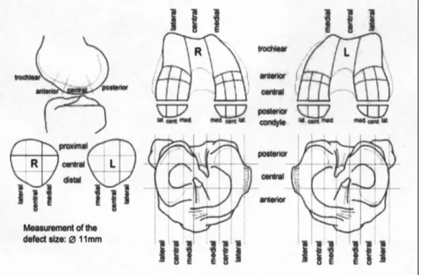 Abb.  2:  Knieschema  des  Operationsprotokolls (Feldeinteilung  von  Femurkondylus, Tibiaplateau und Patella)