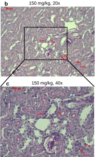 Figure  16:  Histopathological  analysis  of  the  kidneys  after  long-term  Tacrolimus  treatment