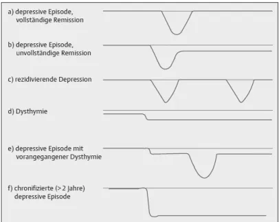 Abbildung 2: Verläufe unipolarer depressiver Störungen [DGPPN, 2009] 