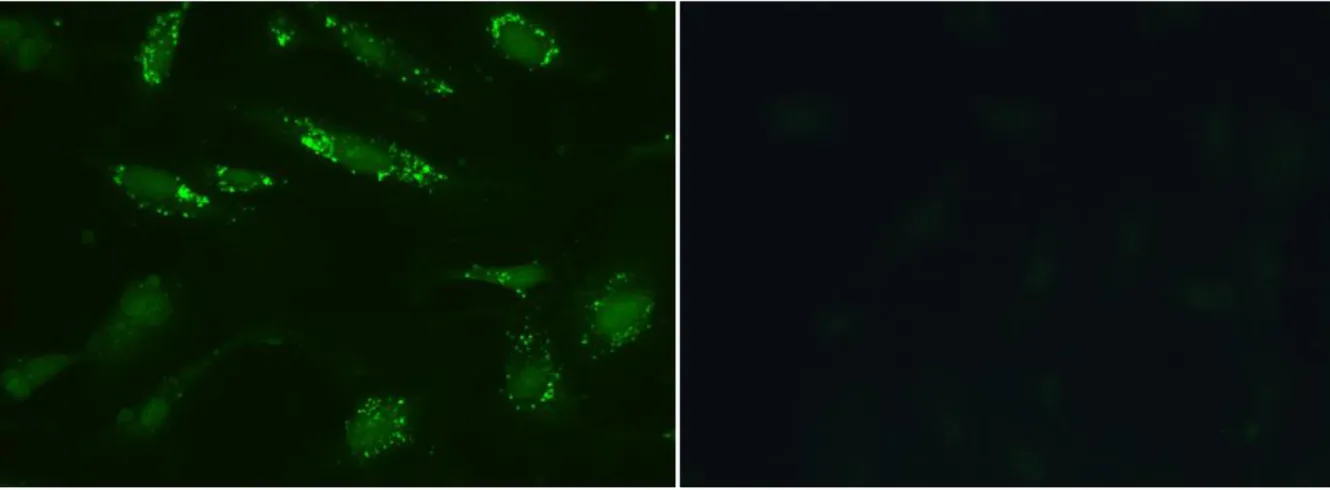 Abbildung 3 Nachweis von AECA mittels indirekter Immunfluoreszenz. Bei der Positivkontrolle (links) zeigt sich eine  positive Reaktion im Zytoplasma (grün), bei der Negativkontrolle (rechts) zeigt sich keine Anfärbung.