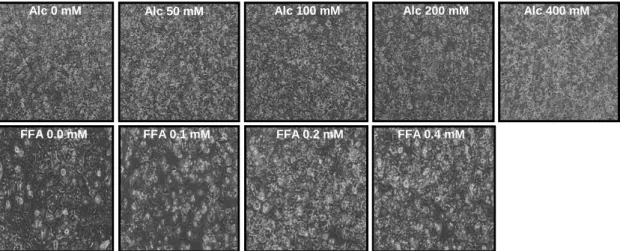 Figure 4.1 PHH, 48 h stimulation with alcohol or FFA. Microscopic images (10X).  