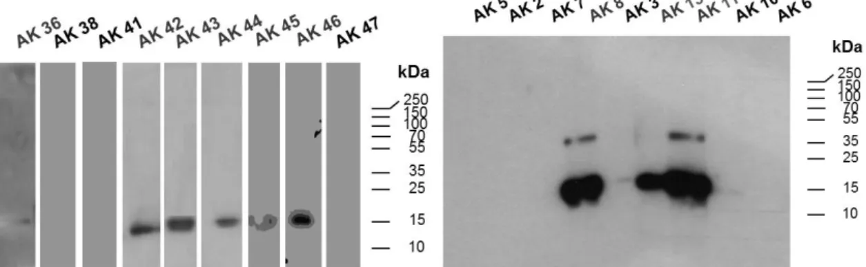 Abbildung  14:  Western  Blot  zur  Testung  der linearen  Bindung  der  Antikörper. 1 µg IL-3/ Lane wurden auf einem  12%igen  SDS-Polyacrylamidgel  aufgetrennt