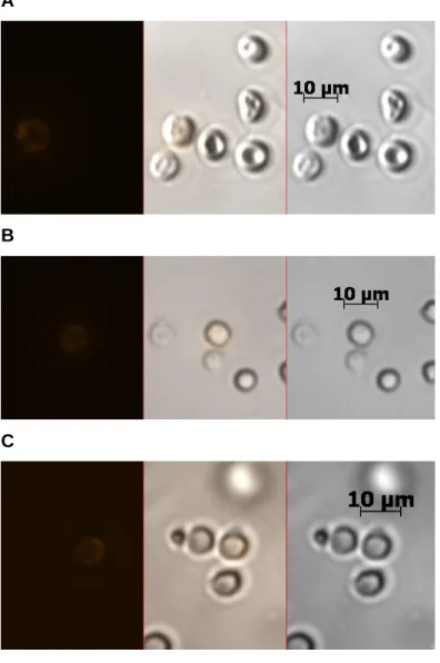 Abbildung 15: Gegenüberstellung MCSP+ Zellen aus Kontrolllymphknoten und  Wächterlymphknoten  