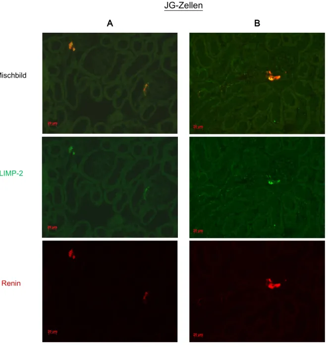 Abb.  3.1  Kofärbung  LIMP-2,  Renin  in  JG-Zellen  (A,  B A,  B A,  B).  Das  grüne  LIMP-2  Farbsignal  ist  sehr  A,  B ausgeprägt  in  Renin  bildenden  JG-Zellen  zu  beobachten