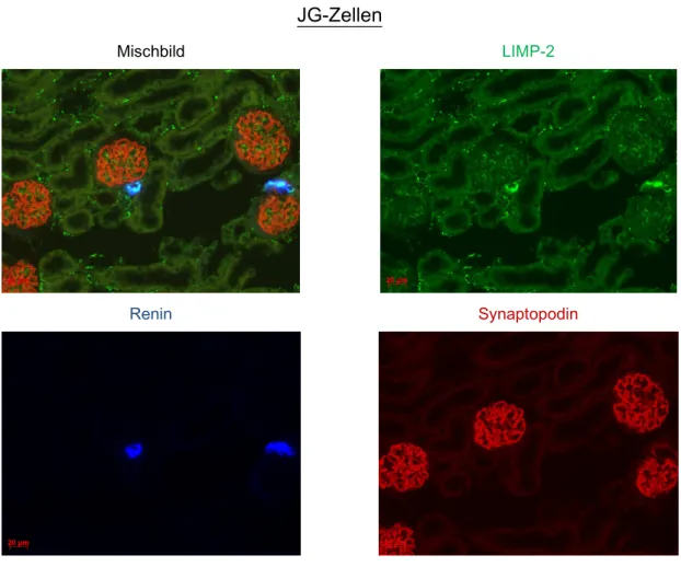 Abb.  3.2    Kofärbung  LIMP-2,  Renin,  Synaptopodin.  Zu  sehen  sind  mehrere  mit  Synaptopodin  (rot)  gefärbte  Glomeruli  und  dicht  daneben  mit  Ren1  (blau)  gefärbte  JG-Zellen