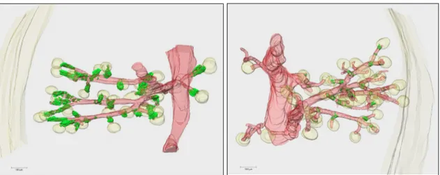 Abb. 3.4 3D-Rekonstruktion eines Gefäßbaumausschnitts einer adulten Vhl fl/fl  -Maus (links)  und einer 