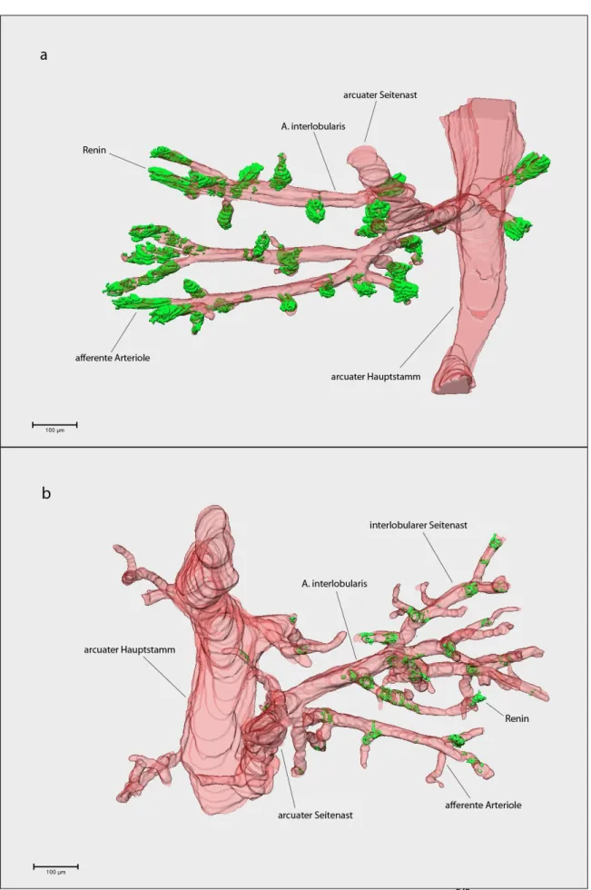 Abb. 3.5 3D-Rekonstruktion eines Gefäßbaumausschnitts einer adulten Vhl fl/fl -Maus (a) und einer 