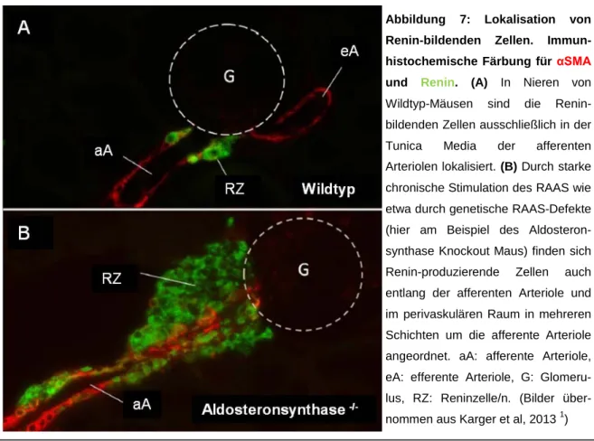 Abbildung 7: Lokalisation von  Renin-bildenden Zellen.  Immun-histochemische Färbung für  αSMA und  Renin