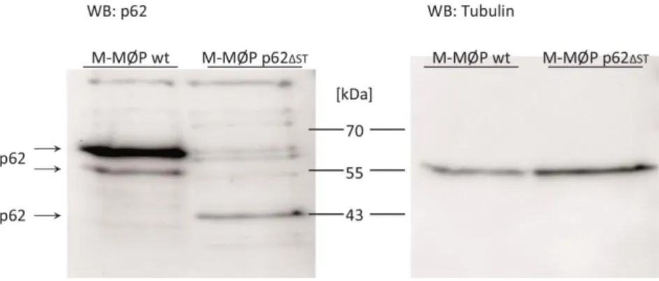 Abbildung 16: Proteinexpression von p62 in p62 ΔST -M-MØP und Wurfgeschwister Kontrolle M-MØP  MØP (2x10 6 Zellen) wurden mittels M-CSF im 6-well-Format ausdifferenziert und über Nacht mit IFNγ  vor-stimuliert