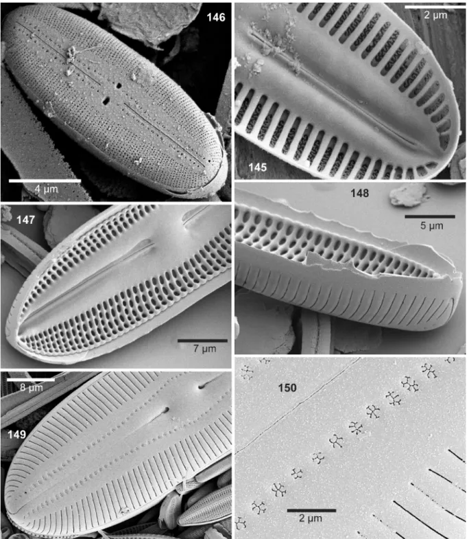 Fig. 145. SEM internal view: D. spec. 2 cf. oculata, Weissensee. Alveoli not subdivided by areolae, sinuous slits visible on the outside (volae)