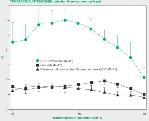 Abbildung 6 Thermoregulatorische Störung bei CRPS-Patienten. Mittlere absolute Seitenunterschiede der  Temperatur der glatten Haut der Hand (Fingerkuppen) bei 25 Patienten mit CRPS I (!), bei 20 gesunden  Kontrollper-sonen (&#34;) und in 15 Alters-parallel