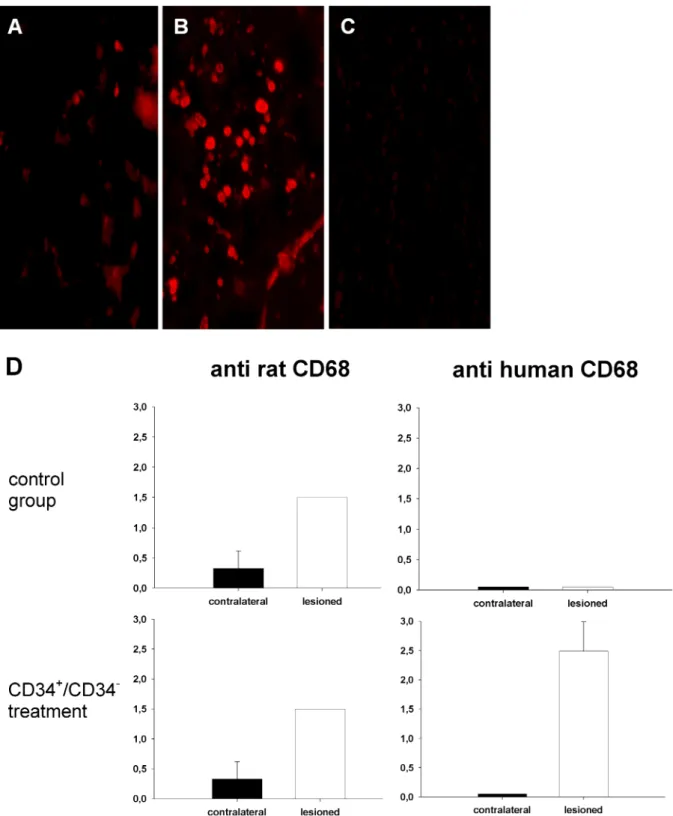 Figure 4: Detection of cells positive for rat or human CD68 in control animals and subjects that received CD34 + /CD34 - cell transplantation