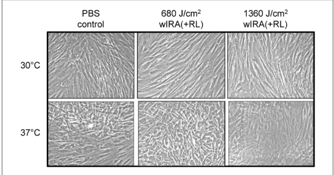 Figure 7: Quantitative real-time RT-PCR analysis of MMP-1 mRNA expression after repeated wIRA(+RL) irradiation Human dermal fibroblasts were exposed to radiation at each cellular passage until passage 10 with a single wIRA(+RL) irradiation dose of 340 J/cm