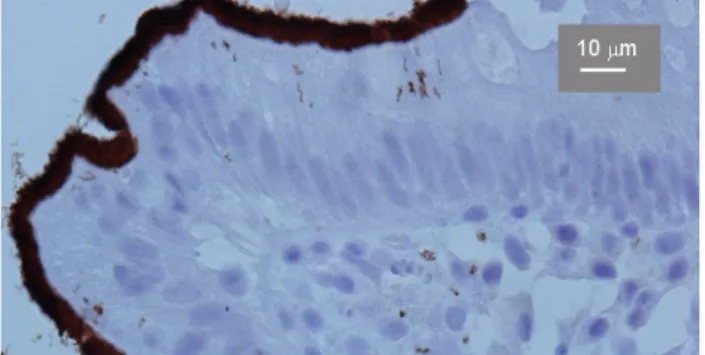 Figure 1: Exfoliative cytology of the rectal mucosa in human spirochetosis with many spirochetes between rod-like