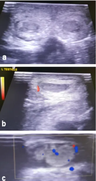 Figure 3: a) Ultrasonography of both testicles. b) Doppler ultrasonography of the right testicle