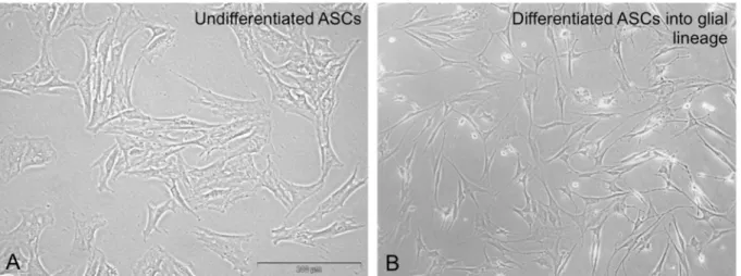 Figure 1: Light microscopy of undifferentiated ASCs in culture (A) and after differentiation into glia cells with characteristic bipolar- bipolar-shape morphology