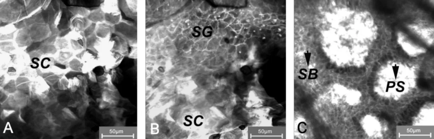 Abbildung 3: Laser-Scan-mikroskopische Darstellung verschiedener Hautschichten. A) Stratum corneum (SC); B) Grenzschicht zwischen dem Stratum corneum (SC) und dem Stratum granulosum (SG); C) Papillarstruktur (PS) mit Blutgefäßen.