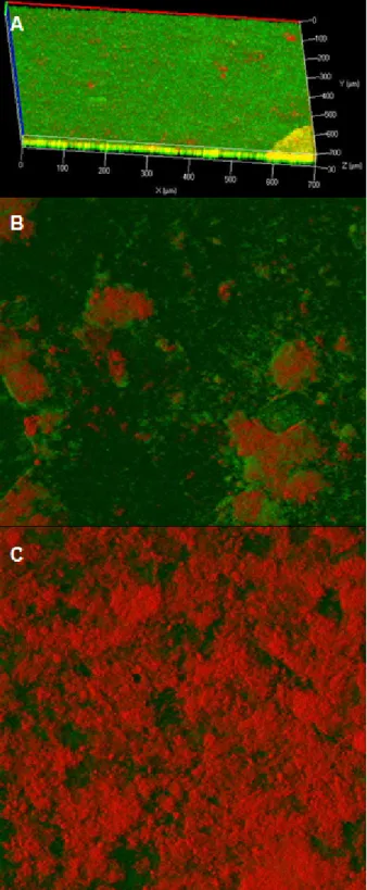 Figure 6: CLSM micrographs: 48-h mature saliva biofilm: (A) untreated, (B) after ozone treatment, (C) after chlorhexidine