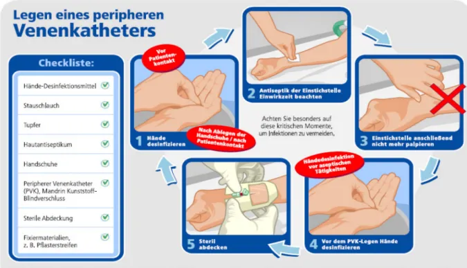 Figure 1: Tablet or poster used as part of the intervention showing a checklist (what do I need for insertion of a peripheral venous catheter?) and the five most important steps for patient safety