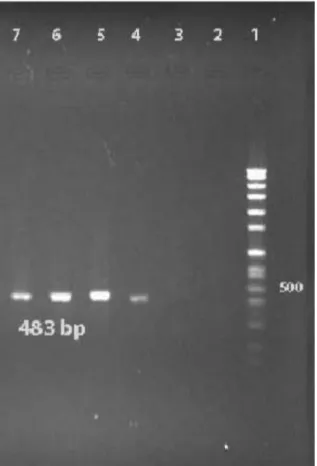 Figure 1: PCR results of ica gene for S. aureus