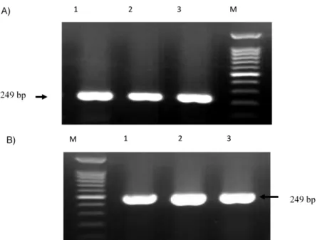 Figure 1: A) PCR amplification of oprI gene among suspected isolates for detection of Pseudomonas spp
