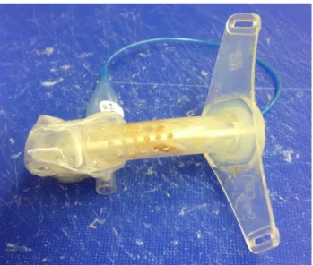 Figure 1: Freshly removed cuffed tracheostomy tube (Heimomed Prima-Phon II, size 8) after 72 hours of wear