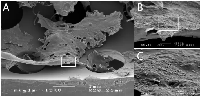 Figure 2: Scanning electron micrography of biofilm deposits on the inner tube surface (A)