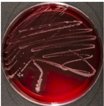 Figure 1: Photobacterium dampselae DSM 110634 growing on Columbia blood agar containing 5% sheep blood (Oxoid, Wesel, Germany)