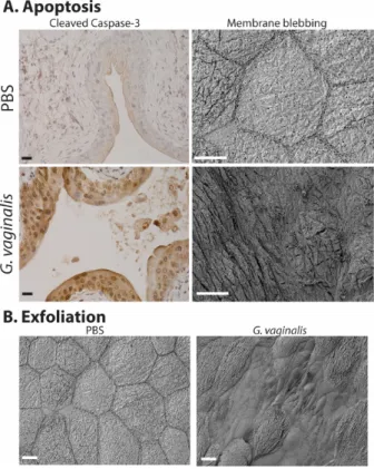 Figure 3: Gardnerella vaginalis induces apoptosis (A) and exfoliation (B) of the mouse bladder epithelium following two transurethral exposures, using our previously reported model