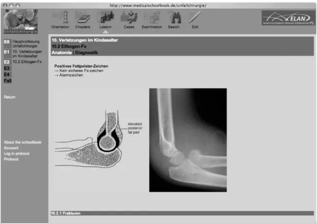 Abbildung 1: Screenshot vom Unfallchirurgie-Schoolbook