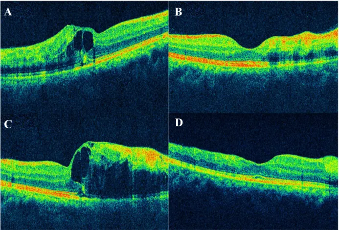 Figure 2: Optical coherence tomography (OCT)