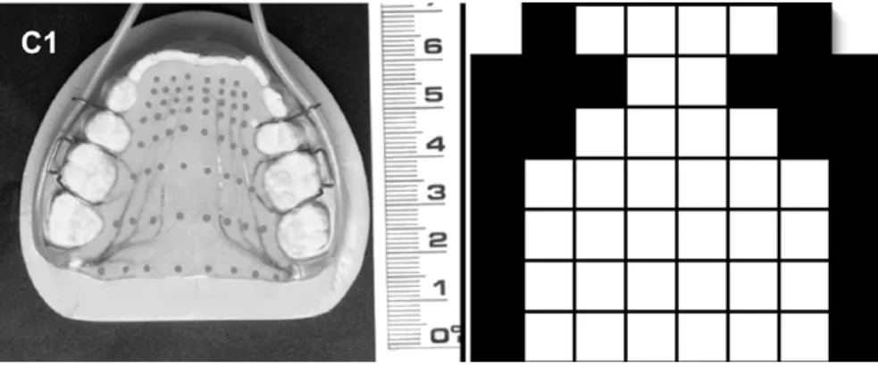 Abb. 8.5: Künstlicher Gaumen mit 62 Elektroden für die Elektropalatographie [links, aus Gibbon &amp; Crampin (2001: 98)] und schematisches Elektropalatogramm des /s/