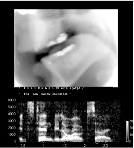 Abb. 8.10: Röntgenaufnahme des Mundraums eines Sprechers bei der Artikulation des Diphthongs /a/ und Sonagramm der Äußerung It’s ten below outside.