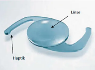 Abb. 10 : IOL mit entsprechenden flexiblen Haptiken, welche die Linse in Position halten