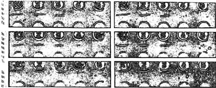 Tab. 1: Bedingungen für den Cl E-Nachweis verschiedener Proteine im Plasma Antigen Fibrinogen Pro-Thrombin Faktor VI l Faktor VI 1 1 Faktor IX Faktor X Faktor XI II A Faktor XIII S Plasminogen Fibronectin Antithrombin III Protein C Protein S - -Antitrypsin