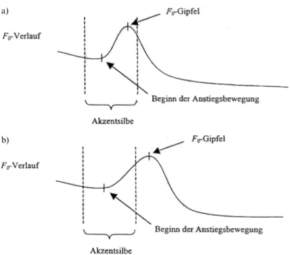 FIG. 1: Typen steigend-fallender Konturen im Berlinischen (Peters 2001, S. 125)b)