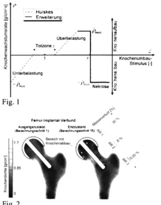 Abb. 2 zeigt die Verteilung der Knochendichte in der  Frontalschnittebene des proximalen Femurs
